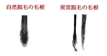 抜け毛 抜け毛