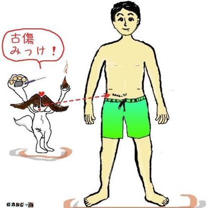 古傷がうずく