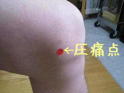 鍼灸師でも膝痛ぐらいあります!