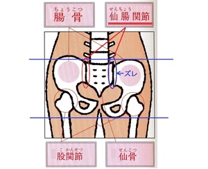 膀胱炎や尿もれ