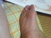背中がいたくて