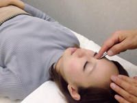 安全な美容はり